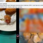 Nasib Baik Tak Telan Wanita Temui Besi Dawai Ketika Makan Nugget Raih Perhatian Netizen