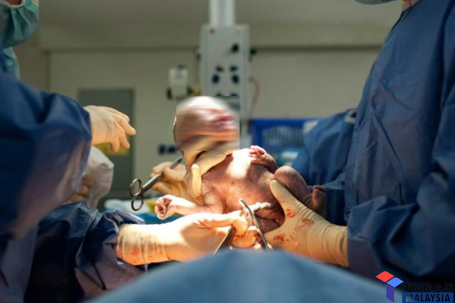 Terkejut pembantu tengok doktor panjat atas perut ibu semata mata nak tarik kepala bayi masa bersalin